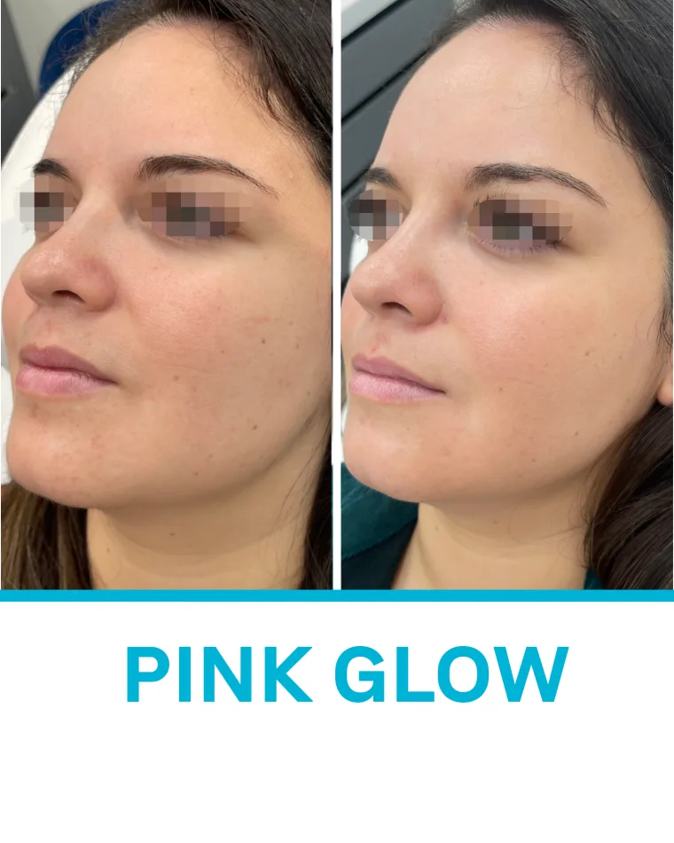 Pink Glow