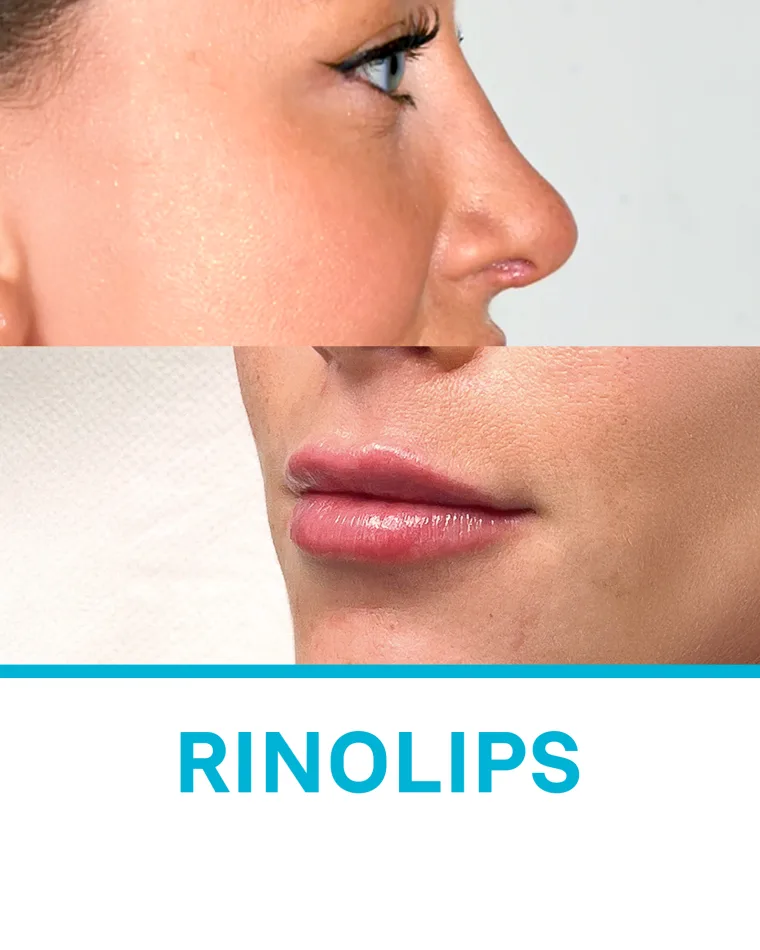 Rinolips